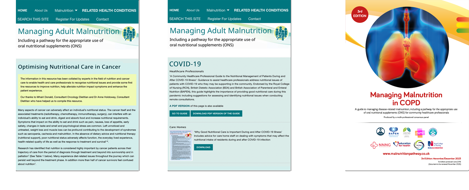 Managing Malnutrition in related health conditions, cancer, covid-19 and copd